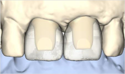 谷歯科の審美歯科