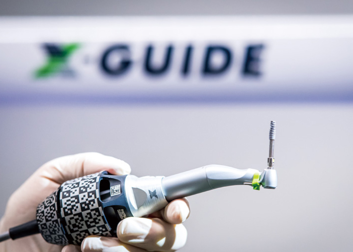 X-Guide