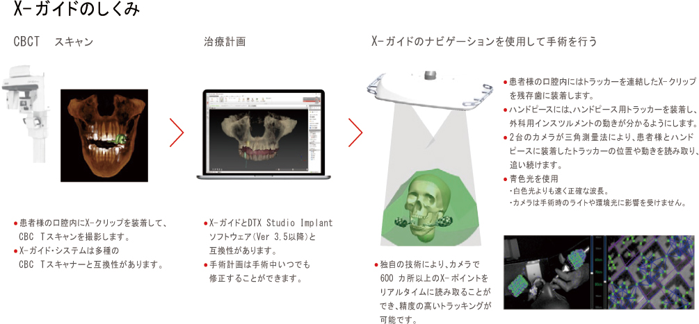 X-Guide